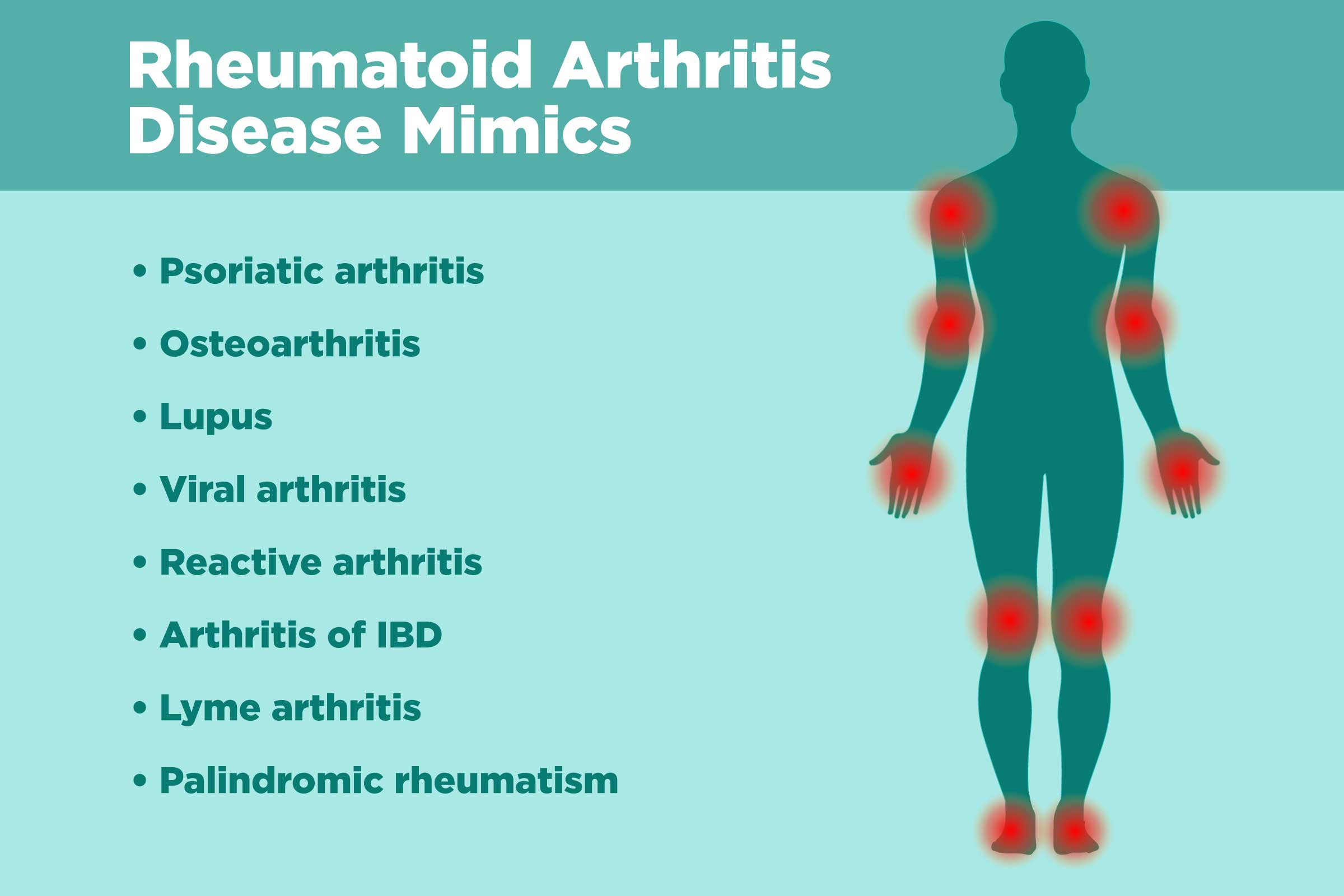What Can Be Mistaken for Rheumatoid Arthritis?